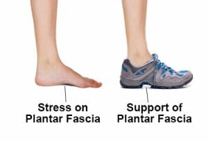 Plantar fasciitis Supportive Footwear