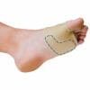 PediFix Sesamoid Relief Sleeve