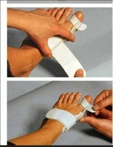 Big Toe Bunion splint