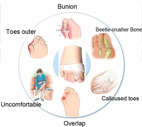 Special Orthopedic Braces