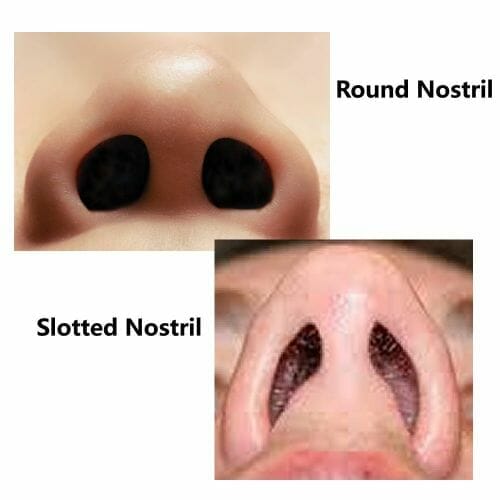 Nasal Dilator