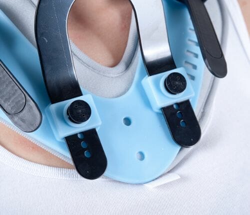 Cervical collar