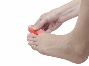 Arthritis Osteoarthritis Big toe joint pain