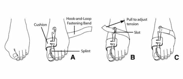 PediFix Nighttime Bunion Regulator - Directions how to use