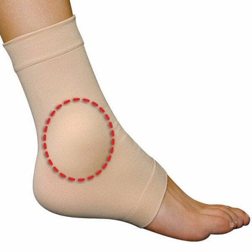 PediFix Visco-gel Ankle Bone Protection Sleeve – Relieves Ankle Pain, Absorbs shock and Friction
