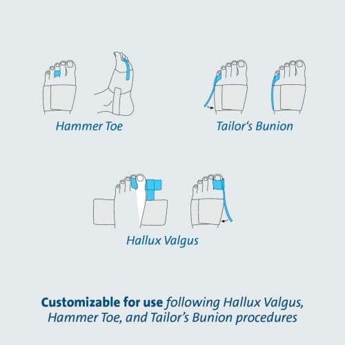 DARCO Toe Alignment Splint – Supports Post-Operative Toe Alignment And ...