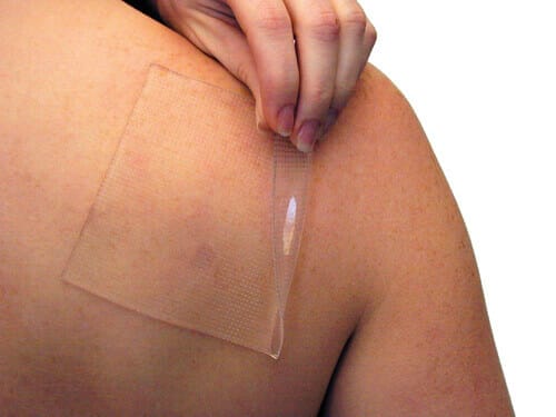 Pedifix Visco-gel Silicone Scar Management Sheets – covers scars